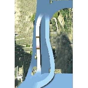 �Ŷ������׳��ѷ� ��ֱ�ű������Ž�����ؽ�