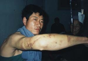 �������������� ������˵���ⶾ��(ͼ��)